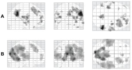 background threshold puncorr  scientific diagram