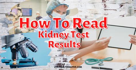 Kidney Test Results Chart