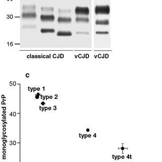 Human Prp Sc Types A Western Blot Developed With Monoclonal Antibody