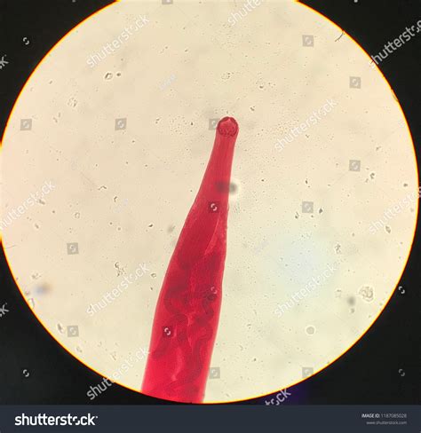 Nematodes Hookworm Ancylostoma Duodenale Necator 45 Off