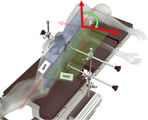 Pelvic Tilt Measurement Of The Anterior Tilt Angle In A Lateral