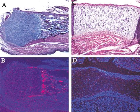 The Novel Zinc Finger Containing Transcription Factor Osterix Is