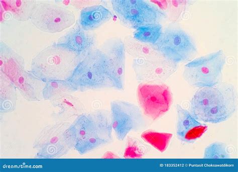 Squamous Epithelial Cells Of Human Cervix Under The Microscope View Coloso