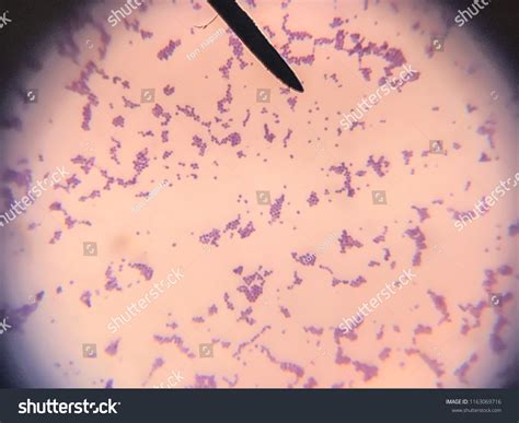 Staphylococcus Under Microscope