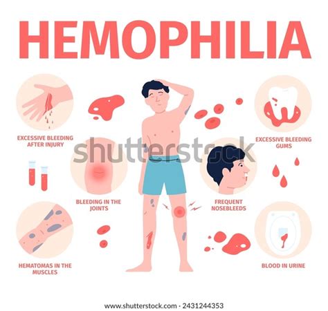 Hemophilia Symptoms Medical Poster About Men Stock Vector (Royalty Free ...