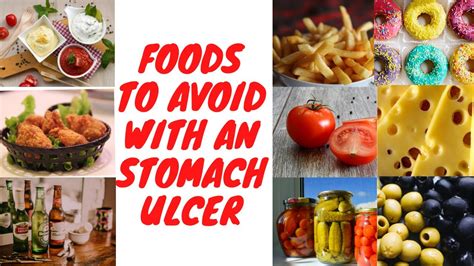 Shocking Foods That Worsen Ulcers Youtube