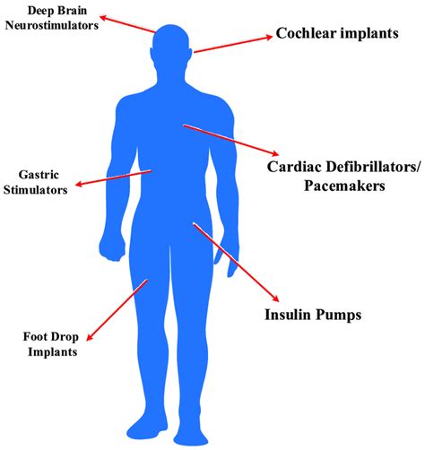 Implantable medical devices for various applications. | Download ...