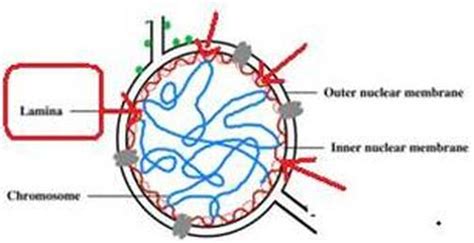 What Causes Progeria Hutchinson Gilford Progeria Syndrome