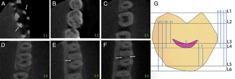 A F Cbct Images Showing The Detection Of The Different Anatomic