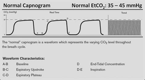 Capnography Waveforms Flashcards | Quizlet