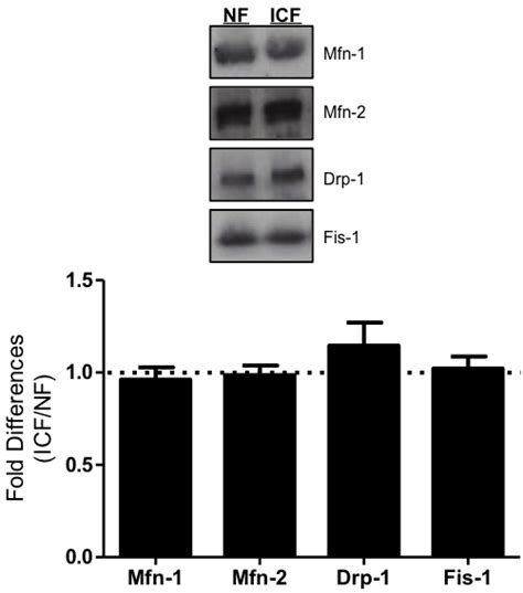 Mitochondrial Morphology Mitochondrial Fusion Mfn 1 Mitofusin 1