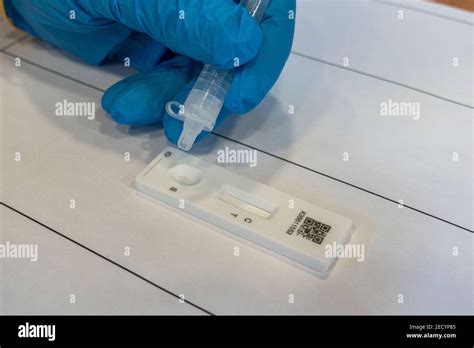 Prueba Cualitativa R Pida Fotograf As E Im Genes De Alta Resoluci N Alamy