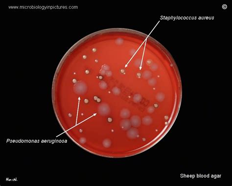 Pseudomonas Aeruginosa On Blood Agar Plate In Petri Dish Appearance