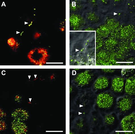 Both 3 And 5 Integrin Are Positioned On The Mdck Primary Cilium A Download Scientific Diagram