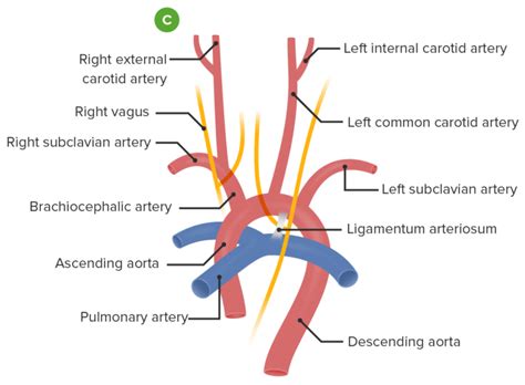 Vascular Rings Concise Medical Knowledge