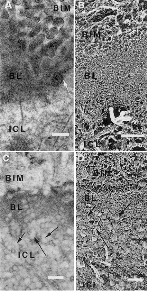 Figure From Quick Freeze Deep Etch Visualization Of Age Related Lipid