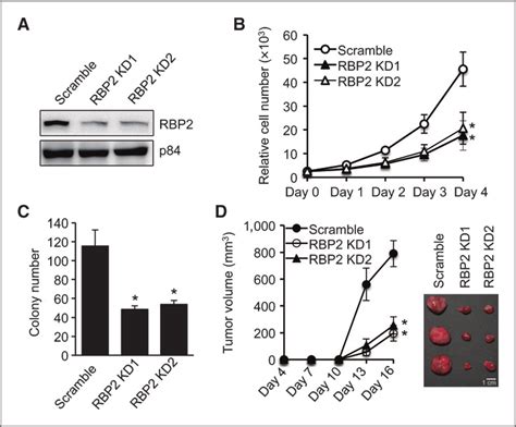 Rbp Depletion Inhibits Growth And Tumorigenesis Of Lung Cancer Cell