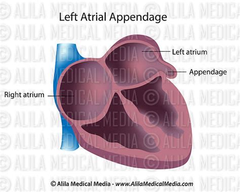 Alila Medical Media Left Atrial Appendage Medical Illustration