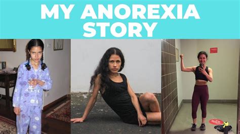 My Anorexia Story By Vivienne On Deviantart Hot Sex Picture