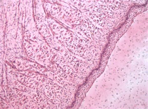 Photomicrograph Showing Stratified Squamous Epithelium On The Ventral