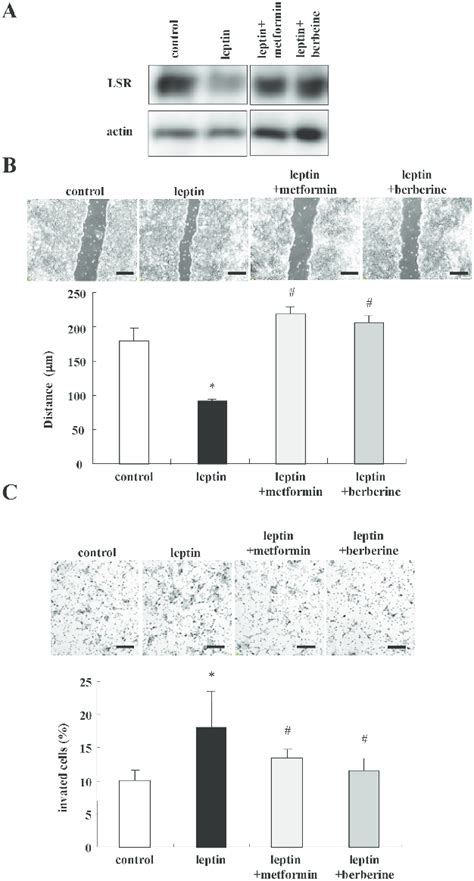 Metformin And Berberine Inhibit Cell Migration And Invasion Induced By