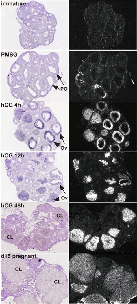 Transcripts For Sfrp 4 Localize To Granulosa Cells Of Periovulatory