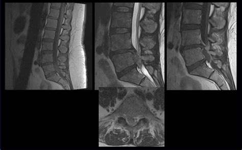 Question 123 MRI Online