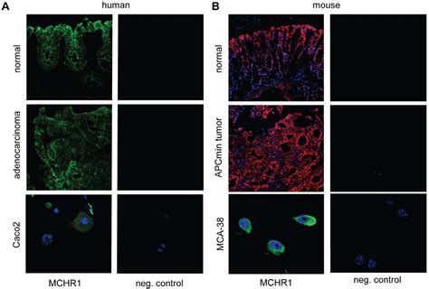 Figure 1 From Reduced Intestinal Tumorigenesis In Apcmin Mice Lacking