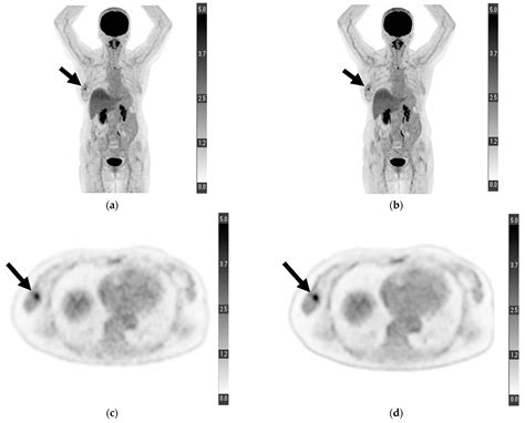 Diagnostics Free Full Text Deep Learning Based Image Quality