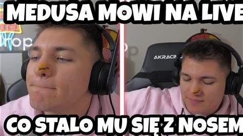 MEDUSA MÓWI CO STAŁO MU SIĘ Z NOSEM YouTube