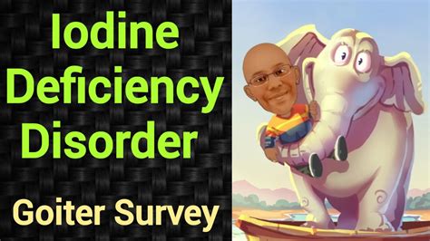 Iodine Deficiency Disorder Goiter Survey Psm Lecture Community Medicine Lecture