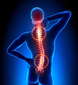 Kyphoplasty A Minimally Invasive Treatment For Major Back Pain Weiss