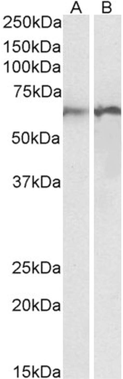 Calreticulin Polyclonal Antibody Pa5 143146