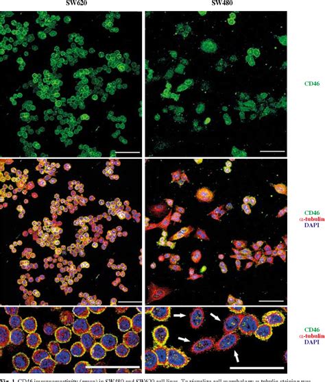 Figure 1 From The Expression Of Membranous Complement Inhibitors Cd46