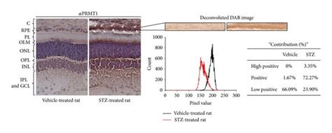 Prmt And Prmt Expression Is Increased In The Rpe Layer Of