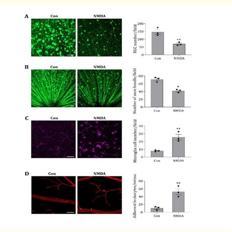 Nmda Induces Rgc And Its Axon Loss Microglial Activation And