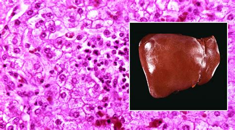 Liver Histology Model