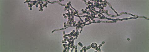 Histoplasma capsulatum Pathogenesis | J. Craig Venter Institute