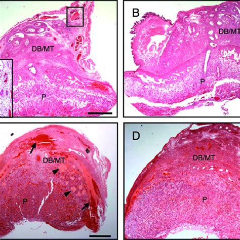 Histological Evidence Of Clotting And Hemorrhage At The Fetal Maternal