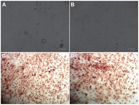 Morphology Characterization Of Primary Renal Tubular Epithelial Cells