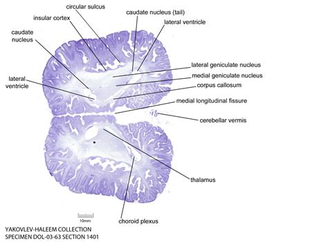 Horizontal Level As Cell Stain