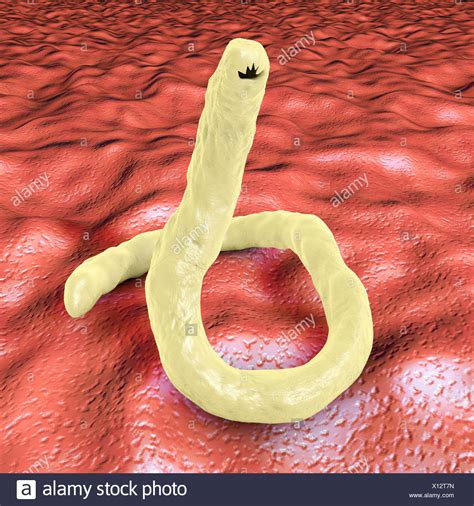 Hookworm Stock Photos And Hookworm Stock Images Alamy