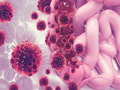 Everything you need to know about colon infection - All About Women