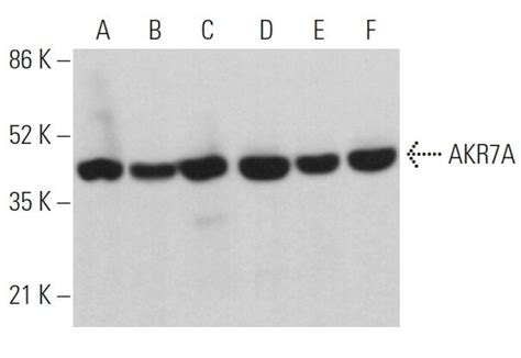 Anti AKR7A Antibody F 8 SCBT Santa Cruz Biotechnology