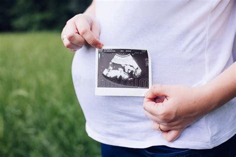 Pregnant Woman Hands Holding Ultrasound Photo Stock Photo - Image of ...