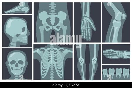 Vector Set Of Knee Leg Pelvis Scapula Skull Elbow Foot Hand And