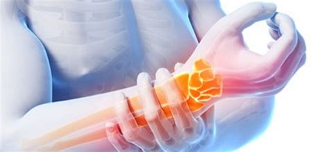 Como Tratar La Tendinitis Blog De Farmacia