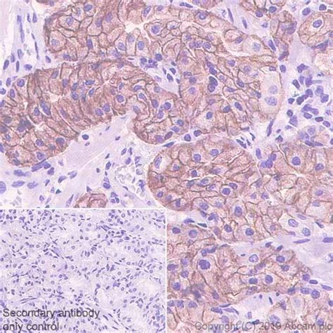 Recombinant Anti Carbonic Anhydrase Ca Antibody Epr Ab