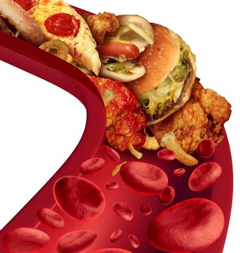 Як накладати електроди для ЕКГ