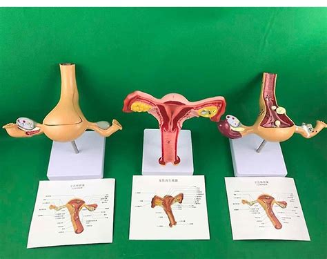 Ovary And Uterus Disease Dissection Model Pathology Female Uterus Model